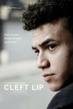Watch Cleft Lip Zoechip