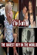 Watch Aidan The Rarest Boy In The World Zoechip