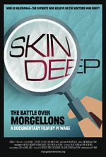 Watch Skin Deep: The Battle Over Morgellons Zoechip