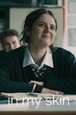 Watch In My Skin Zoechip