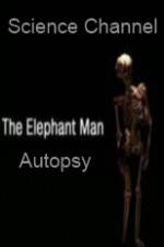 Watch Science Channel Elephant Man Autopsy Zoechip