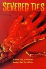 Watch Severed Ties Zoechip