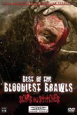 Watch TNA Wrestling: Best of the Bloodiest Brawls - Scars and Stitches Zoechip