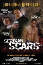 Watch Serbian Scars Zoechip