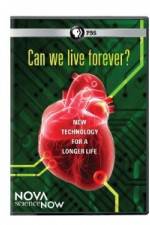 Watch Nova Science Now: Can We Live Forever Zoechip