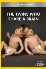 Watch National Geographic The Twins Who Share A Brain Zoechip