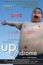 Watch Up Syndrome Zoechip