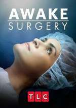 Watch Awake Surgery Zoechip