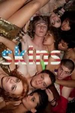 Watch Skins (US) Zoechip