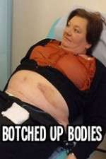 Watch Botched Up Bodies Zoechip