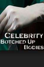 Watch Celebrity Botched Up Bodies Zoechip