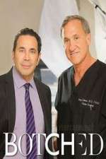 Watch Botched Zoechip