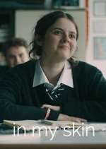 Watch In My Skin Zoechip