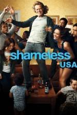 Watch Shameless USA Zoechip